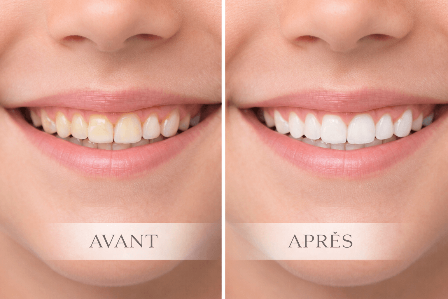Sourire Parfait
