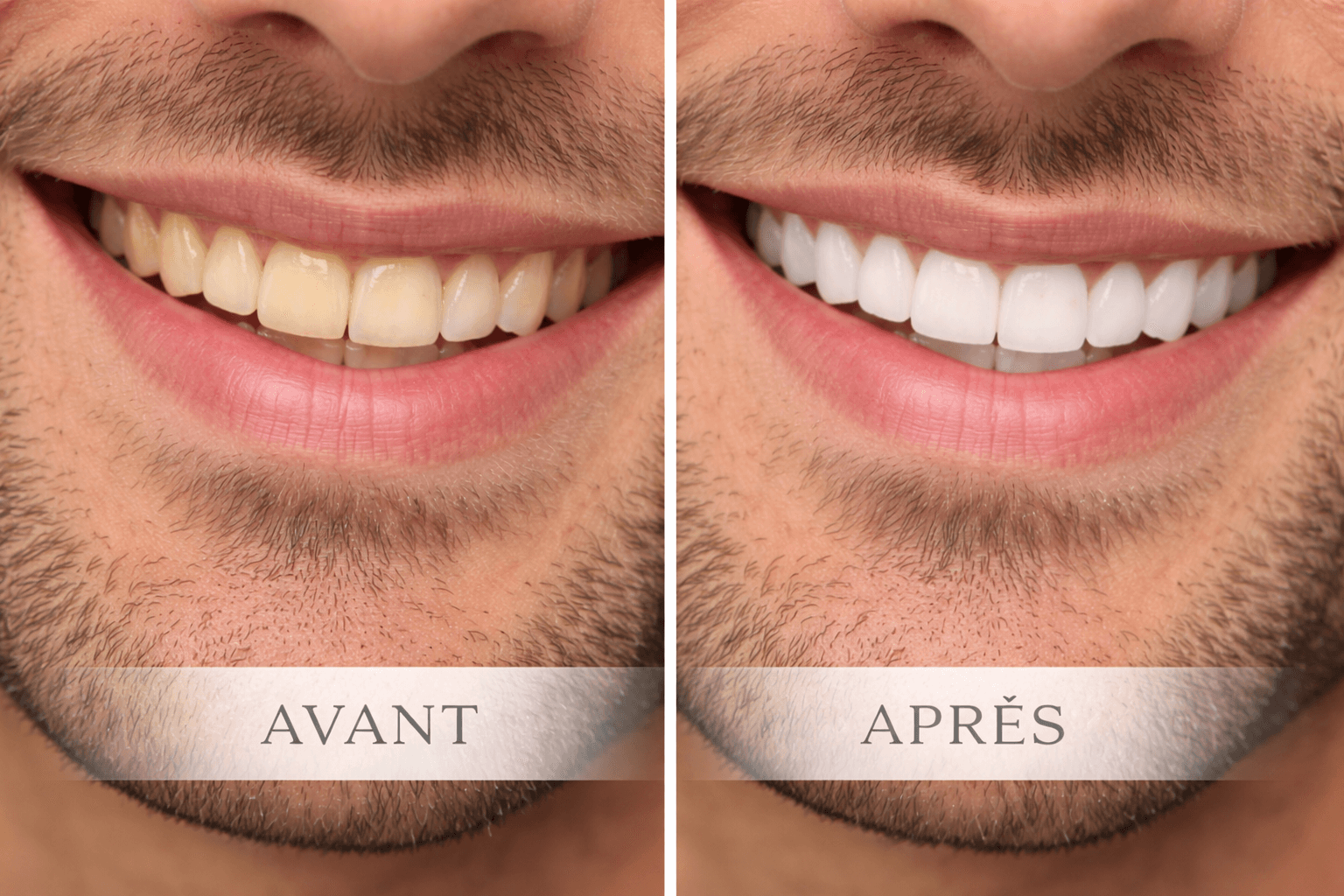 Équipement Moderne